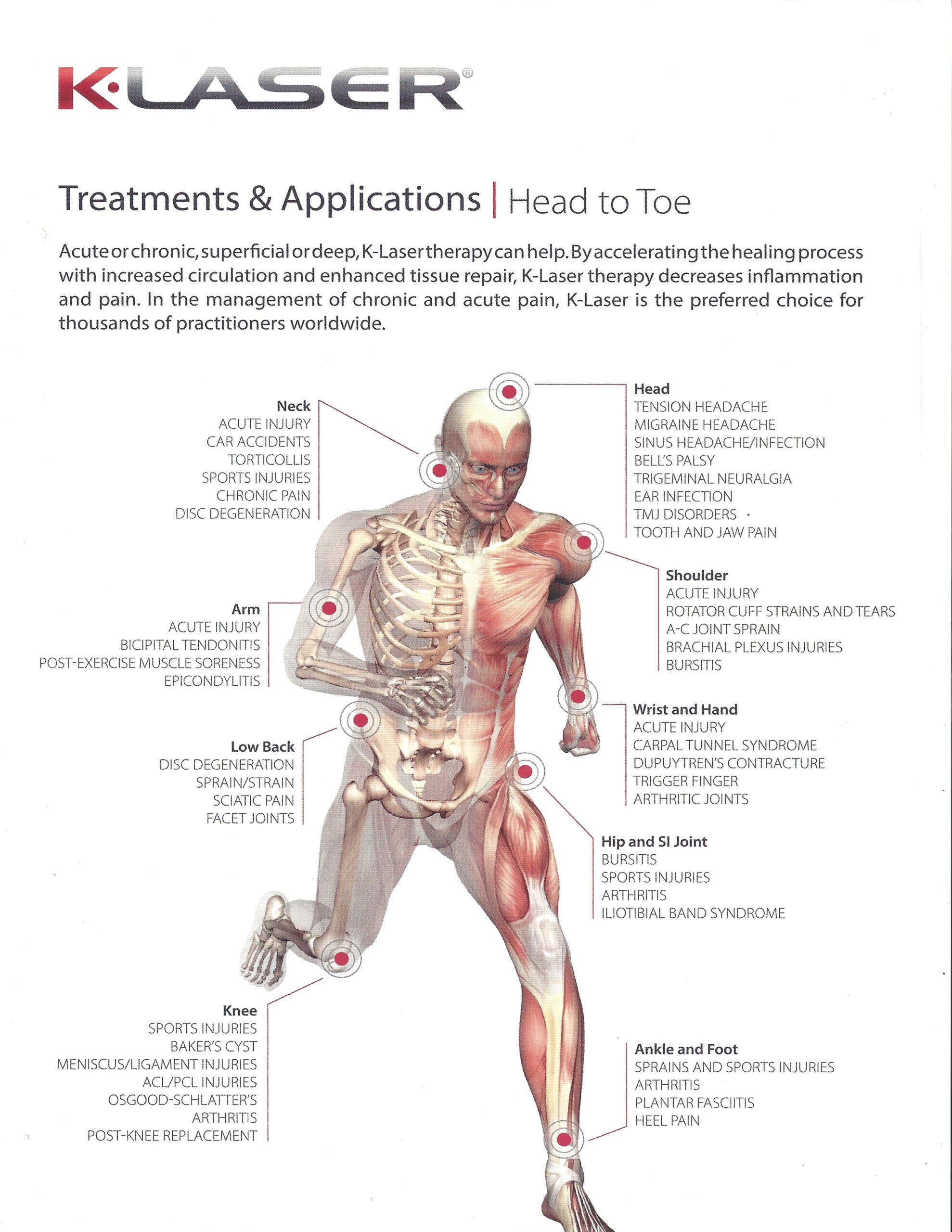 Image of bones and muscles showing application areas ideal for K-Laser treatments